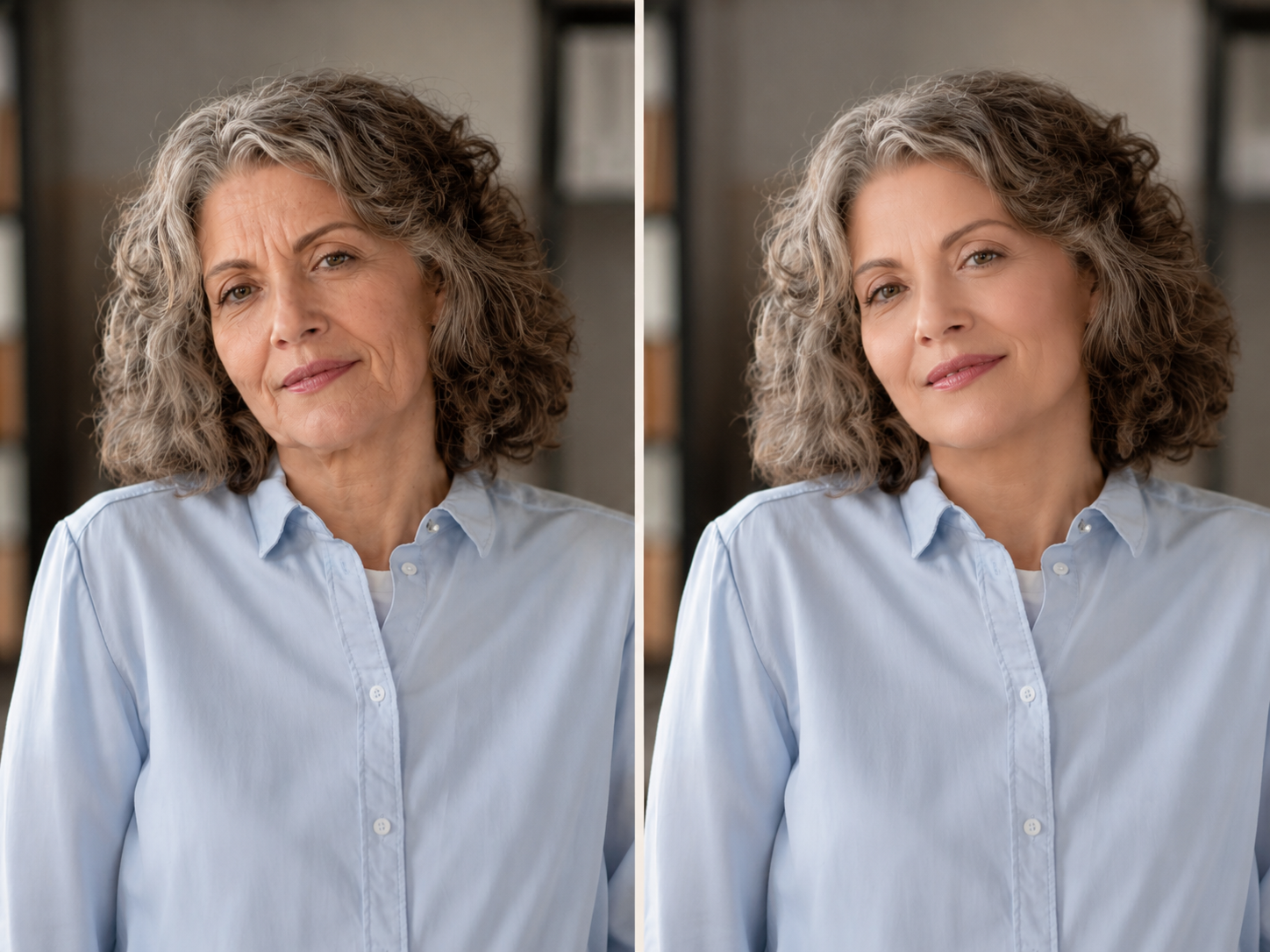 Prima e dopo — Carla, 61 anni